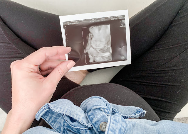 Pregnancy picture